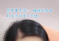 女人头发掉得厉害该怎么办（解决女性脱发的7个方法）
