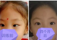 从生活习惯到遗传基因，看看斜视的真正原因（从生活习惯到遗传基因）