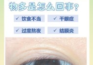 为什么会有过多的眼屎（原因）
