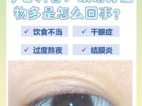为什么会有过多的眼屎（原因）
