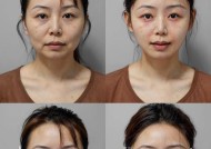 告别“胖脸”（15个简单易行的方法）