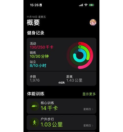 苹果手表指控功能的设置步骤是什么？  第2张