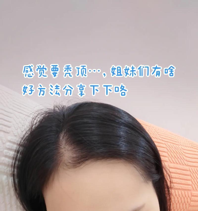 女人头发掉得厉害该怎么办（解决女性脱发的7个方法）  第1张