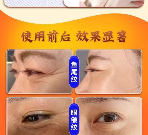 告别眼角鱼尾纹，这些方法最有效（如何去除眼角鱼尾纹）  第1张