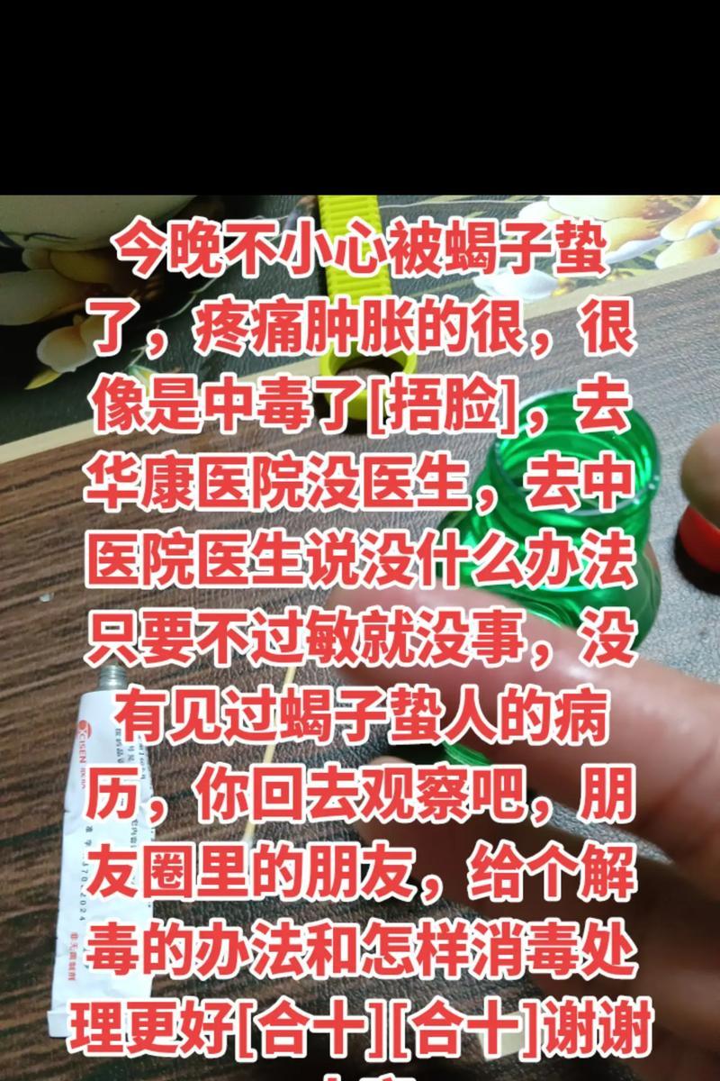 蝎子蛰了怎么办（应对蝎子蛰伤的方法及注意事项）  第3张