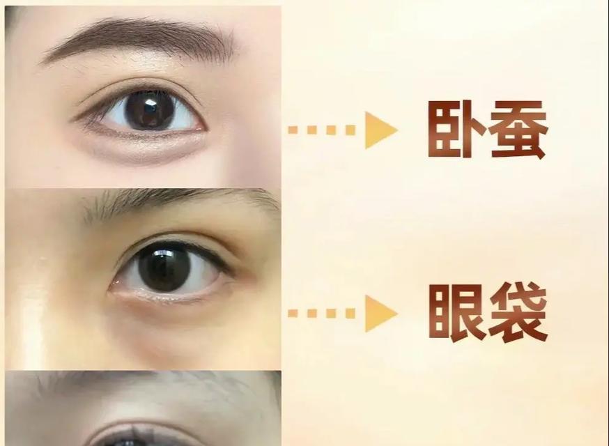 眼袋和卧蚕的区别（如何辨别眼袋和卧蚕）  第3张