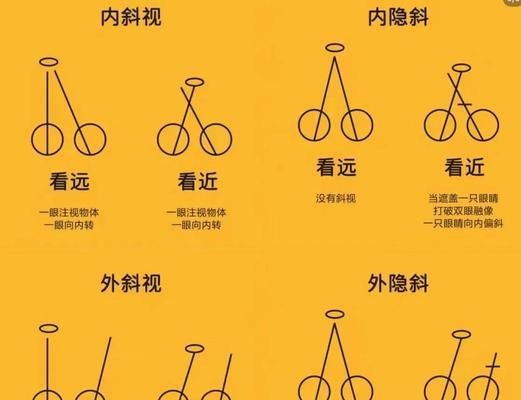 眼睛斜视矫正方法详解（从基础知识到治疗方案）  第1张