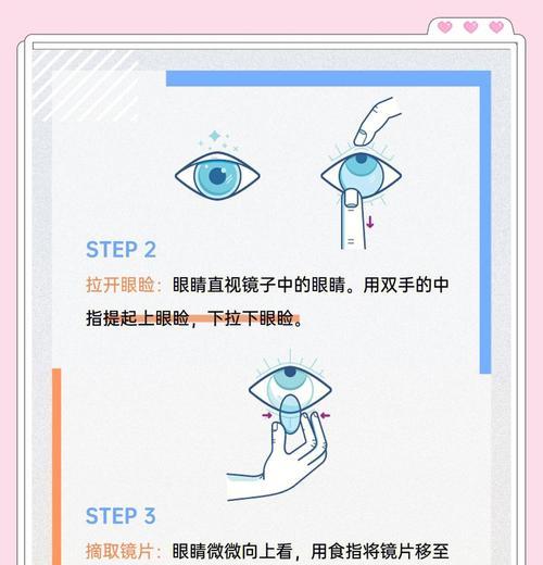 视频眼镜摘除时需要注意什么？  第2张